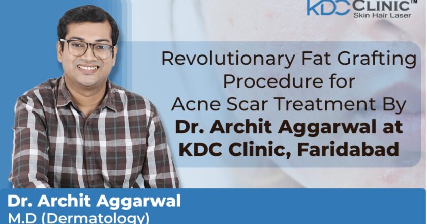 Dr. Archit Agarwal of KDC Clinic Faridabad Revolutionizes Acne Scar Treatment with Innovative Fat Grafting Procedure