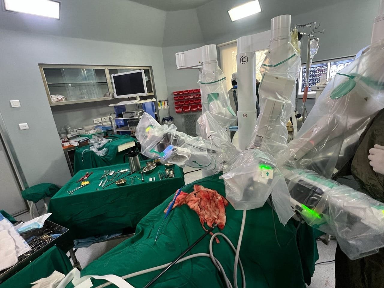 Marengo CIMS Hospital Performs Gujarat’s First Robotic Decortication ...